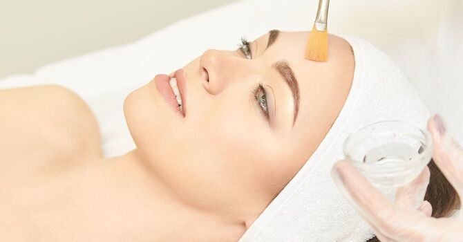 Chemical Peels